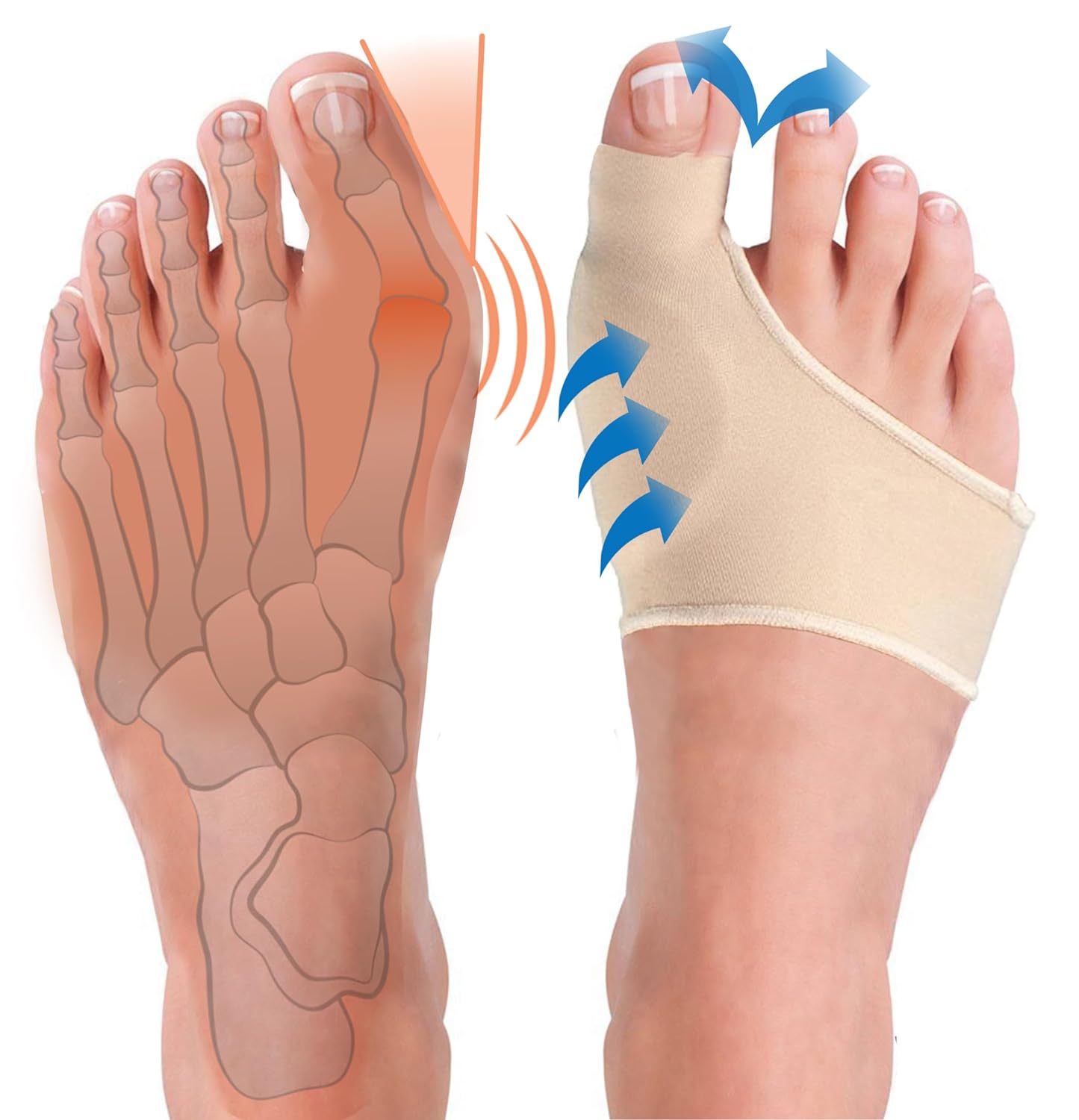 Almohadilla de gel para juanete